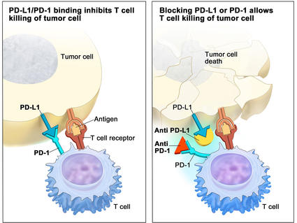Two-panel illustration showing the interaction between T cells and tumor cells. The left panel is titled "PD-L1 binds to PD-1 and inhibits T cell killing of tumor cell" and shows an antigen and T cell receptor, illustrating the inhibition of T cell activity. The right panel is titled "Blocking PD-L1 or PD-1 allows T cell killing of tumor cell" and shows tumor cell death, indicating successful T cell activity.