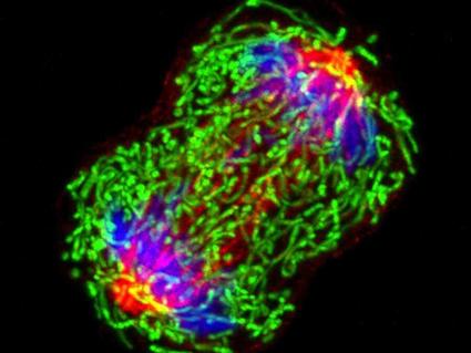Breast cancer cell undergoing cell division.