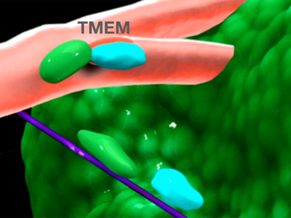 Illustration of TMEM chemo induced metastasis