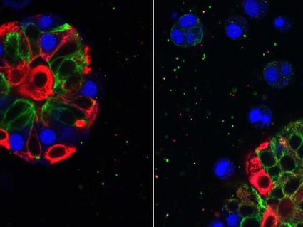 Two images show fluorescently colored cells under a microscope. On the left, a cluster with visible blue, red, and green components. On the right, the blue is dispersed while the red and green maintain their original form.