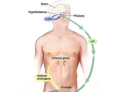 Illustration of the male endocrine system focusing on hormone regulation. It shows the brain, hypothalamus, and pituitary gland producing LHRH, which stimulates the release of LH. Arrows indicate the feedback loop of hormone regulation within the body.