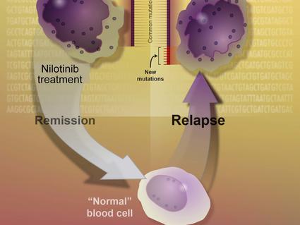 Illustration showing how nilotinib inhibits the BCR-ABL protein in chronic myeloid leukemia cells, leading to reduced cancer cell proliferation.