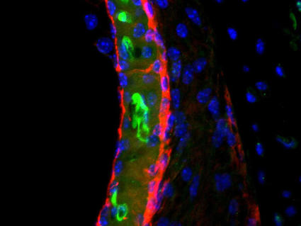 Microscopic view of a mouse inner ear showing cisplatin drug in green.