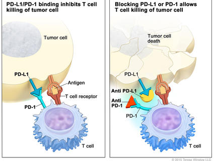 Two-panel illustration showing the interaction between T cells and tumor cells. The left panel is titled "PD-L1 binds to PD-1 and inhibits T cell killing of tumor cell" and shows an antigen and T cell receptor, illustrating the inhibition of T cell activity. The right panel is titled "Blocking PD-L1 or PD-1 allows T cell killing of tumor cell" and shows tumor cell death, indicating successful T cell activity.