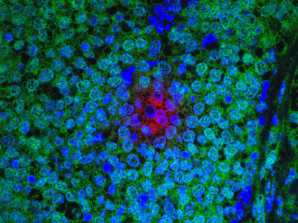Fluorescent microscopy image of tissue showing a dense arrangement of cells. The cells are stained with various colors: bright blue, green, and a prominent cluster of red near the center. The vibrant colors highlight different cellular components or markers, providing insight into the tissue's structure and function.