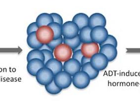 Diagram showing prostate cancer progression and regression with ADT, highlighting hormone-sensitive and resistant cells.
