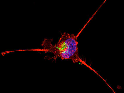 A vivid microscopy image of a single cell on a black background. The cell features a bright blue nucleus with green spots inside it, surrounded by red extensions that spread outwards. 