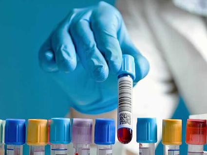 Gloved hand picking up a capped vial of blood from a tray holding additional capped vials.