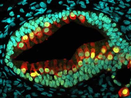 An inner ear "organoid" showing hair cells (red) and hair cell bundles (yellow).
