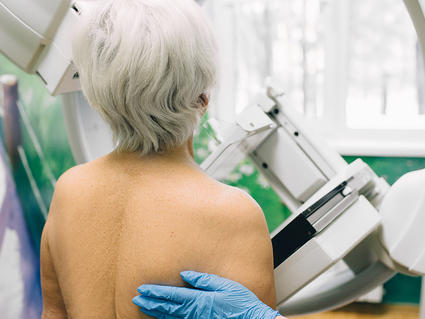 Senior woman having a mammography scan