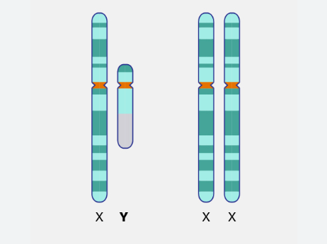 Y Chromosome Loss in Men: An Early Warning Sign for Cancer