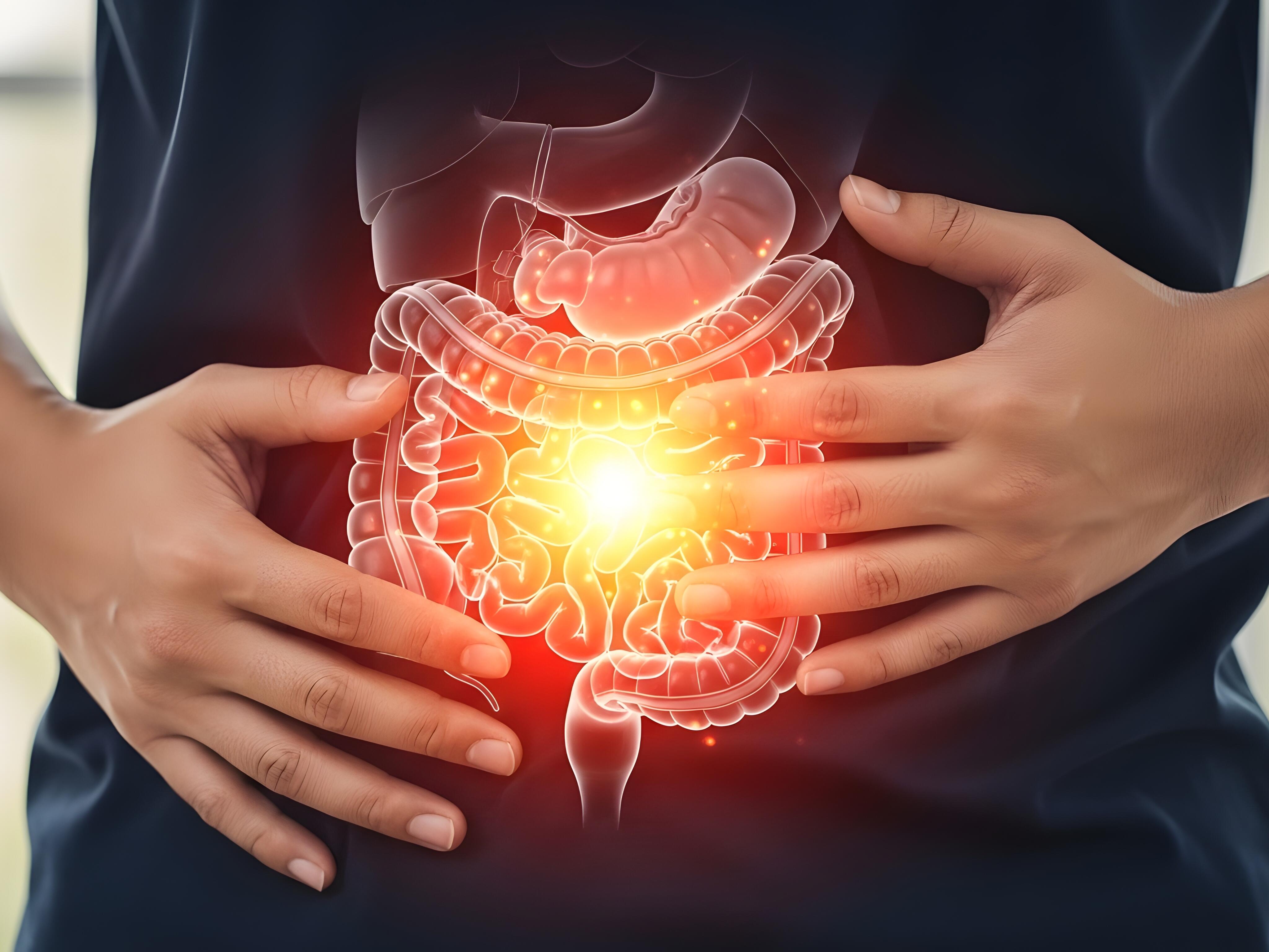 Photo: cancer.gov Hidden Inflammation Drives High Colon Cancer Risk, Garvan Research Reveals