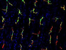 Fluorescent microscopy image showing a receptor (green) on immune cells called macrophages (red).