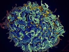 A human T cell being attacked by the human immunodeficiency virus (HIV).
