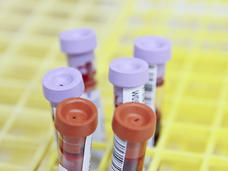 Blood collection tubes with colored caps (purple and red-orange) in laboratory test tube rack.
