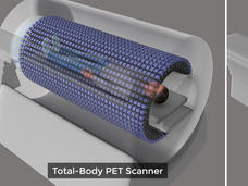 Diagram showing a full-body PET scan and a standard PET scan.