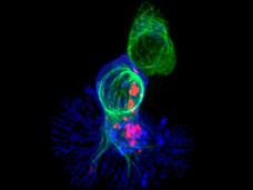 A killer T cell (blue) engaging a target cell, with cell-killing molecules (red) traveling along the target cell's cytoskeleton (green).