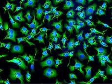 Small green shapes with blue centers fade into a black background. The green shapes are fairly dense and are sized similarly.