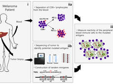 A four-panel infographic. The first panel is titled Melanoma Patient, with blood and tumor biopsy labeled on a man’s silhouette. The blood label points to a panel titled “separation of CD8 + lymphocytes from the blood”. The tumor biopsy label points to a panel titled “sequencing of tumor to identify potential mutated antigens”. These two panels point to a final panel about the measurement of reactivity of peripheral immune cells to mutated antigens.