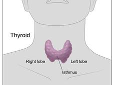 Schematic of a thyroid gland.