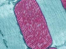 A pink-red rectangle with rounded corner and wavy lines of varying lengths (mitochondria) sits on top of a light teal background with vertical striations and some small irregularities.