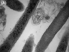 Electron micrograph of Fusobacterium nucleatum, a bacterium linked to colorectal cancer growth and spread.