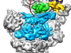 Bortezomib blocks the action of the proteasome.