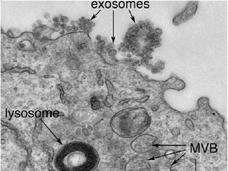 A transmission electron micrograph of a cancerous B cell that has secreted exosomes.