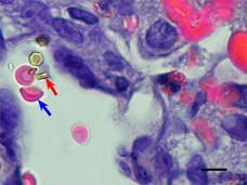 A stained slide mostly colored purple with some red and pink highlights. In a large area of white, red blood cells have a blue arrow pointing at them, and an iNPG-pDox nanoparticle has a red arrow pointing at it. 