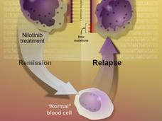 Illustration showing how nilotinib inhibits the BCR-ABL protein in chronic myeloid leukemia cells, leading to reduced cancer cell proliferation.