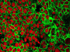 Red cells on a black background with neon green coloring between some of the cells.