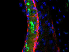 Microscopic view of a mouse inner ear showing cisplatin drug in green.