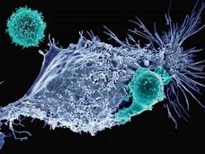 Image of CAR T cells attacking a cancer cell.