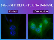 Images of human fibroblast cells in their resting state and same cells after exposure to DNA-damaging chemotherapy.