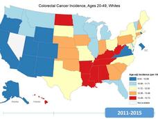 U.S. map illustrates colorectal cancer incidence rates among white individuals aged 20-49 from 2011 to 2015. States are color-coded based on age-adjusted incidence per 100,000: light yellow for 9.03-10.98, light blue for 10.99-11.71, light orange for 11.72-12.55, dark blue for 12.56-13.48, and red for 13.49-15.73. Stripes indicate unavailable data.