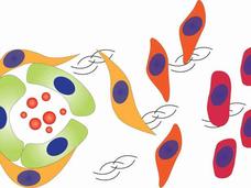Diagram illustrating tumor cell progression from a primary site (left) through migration (center) to distant metastasis (right), representing the formation of a pre-metastatic niche.