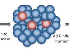 Diagram showing prostate cancer progression and regression with ADT, highlighting hormone-sensitive and resistant cells.