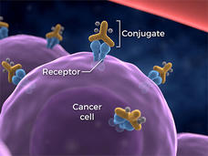 A computer generated image of a cancer cell with antibody–photoabsorber conjugates attached to it. The cancer cell is a bumpy purple sphere. The antibody-photoabsorber is two parts: first, two blue columns with a spherical top emerge from the cell (receptors). On top of the two columns, a three-sided shape sits on top of the columns (a conjugate). The conjugate has three grey spheres attached to it. Multiple photoabsorbers are attached to the cancer cell.