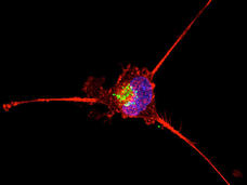 A vivid microscopy image of a single cell on a black background. The cell features a bright blue nucleus with green spots inside it, surrounded by red extensions that spread outwards. 