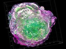 3D digital reconstruction of a mouse cell overexpressing the HER2 protein (shown in green) surrounded by purple cellular structures, demonstrating the protein associated with aggressive breast cancers.