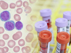 A collage of a close of pathology slide - cells that are mostly pink with a light center alongside three purple cells with blue exteriors - fading into six blood samples in tubes. The tubes have labels that have a bar code and light purple or orange tops. 