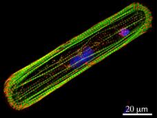 Microscopic image of stem cell-derived heart muscle cell. 
