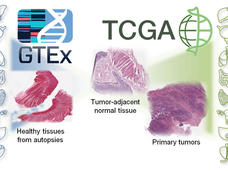 Collage depicting two major research projects: GTEx and TCGA. On the left, GTEx is represented with a blue silhouette and icons of various organs. On the right, TCGA features a green silhouette with similar organ icons, focusing on tumor-adjacent normal tissue and primary tumors. Central images showcase tissue samples.