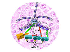 Illustration of a complex signaling pathway overlaid on a background of stained cells. It depicts the activation of the NF-kB pathway, featuring components like the CBM complex, cIAP1/2, LUBAC, and IKK, represented in various colors. Arrows indicate the flow of signaling events, highlighting the interactions that lead to NF-kB activation.