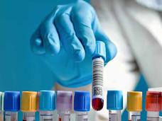 Gloved hand picking up a capped vial of blood from a tray holding additional capped vials.