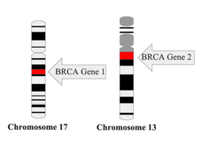 Illustration of BRCA Gene 1 (chromosome 17) and BRCA Gene 2 (chromosome 13)