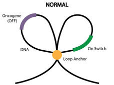 A graphic explaining epigenetic changes in normal cells and SDH-deficient GIST.