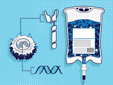 A conceptual image of CAR T cell therapy, including DNA, at T cell, and an infusion bag.