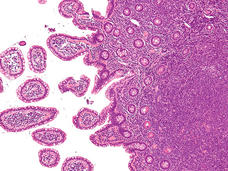 A microscopic image of tissue, showing intricate cellular structures stained in shades of pink and purple. The section reveals a dense cluster of cells on the right, transitioning to more separated, circular formations on the left.