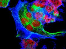 A fluorescence micrograph of neuroblastoma cells, with cell nuclei stained red. Areas of neon green and blue encase the red cell nuclei. The background of the image is black.
